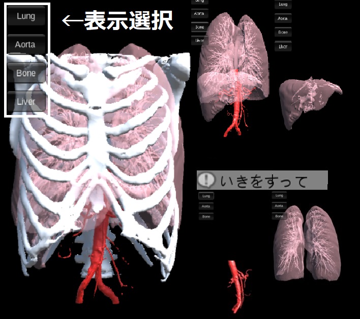 肺の問診システム